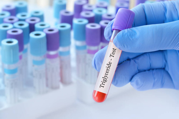 Médico sosteniendo un tubo de muestra de sangre de prueba con prueba de triglicéridos en el fondo de los tubos de prueba médica con análisis - Foto, Imagen