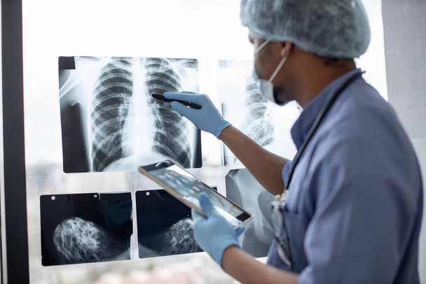 Fókuszáljon a mellkas röntgen vizsgálatára, amelyet multiraciális egészségügyi szakember tanulmányozott védőöltözetben, injekciós tollal ellátott tablettát használva. Férfi radiológus azonosítására tömeg a bal tüdőben technológiát alkalmazó. - Fotó, kép