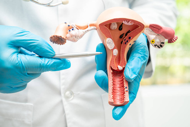 Uterus, doctor holding anatomy model for study diagnosis and treatment in hospital. - Foto, Imagem