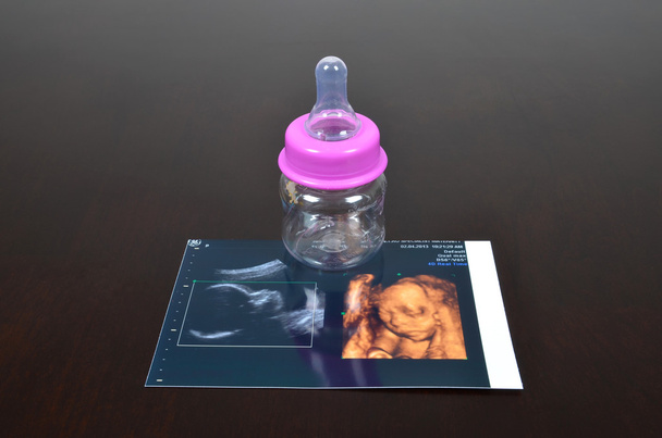 Babyflasche mit Ultraschallbildern - Foto, Bild