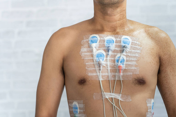 Hombre con dispositivo de monitor de electrocardiograma de 24 horas en el pecho, electrodos ritmo Holter monitoreo y sistema de monitor de presión arterial en el pecho de un hombre. Concepto de cardiopatía sanitaria. - Foto, imagen