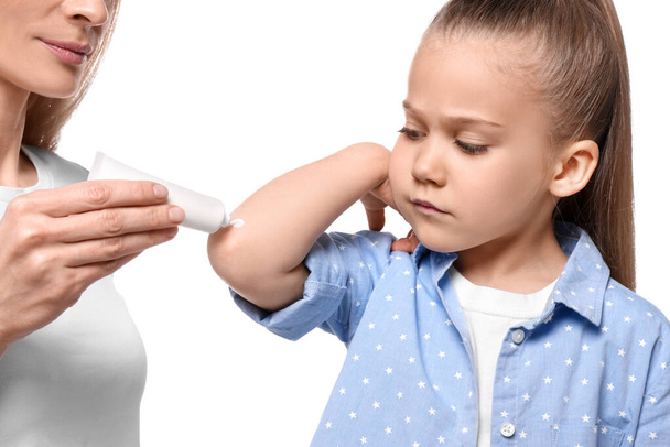 Mother applying ointment onto her daughter's elbow against white background - Photo, Image