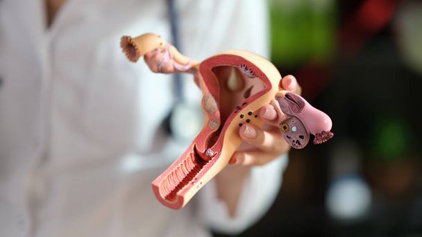 Primer plano de la ginecóloga mujer que sostiene el modelo anatómico del útero y los ovarios. Sistema reproductivo femenino saludable, medicina, concepción, concepto de educación - Foto, Imagen