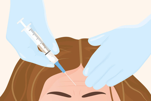 injekce botulotoxinu do ženského čela, korekce vrásek; estetická medicínská klinika - vektorové ilustrace - Vektor, obrázek