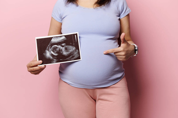 Средняя часть беременной женщины, указывающая на живот, показывающая свою новорожденную сонографию, ультразвуковую картинку, на изолированном розовом фоне. Беременность. Материнство. В ожидании детского образа жизни - Фото, изображение