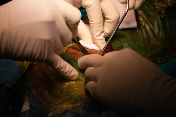 Χειρουργός χέρι με χειρουργική λεπίδα κάνει τομή κατά τη διάρκεια της χειρουργικής επέμβασης στο χειρουργείο. - Φωτογραφία, εικόνα