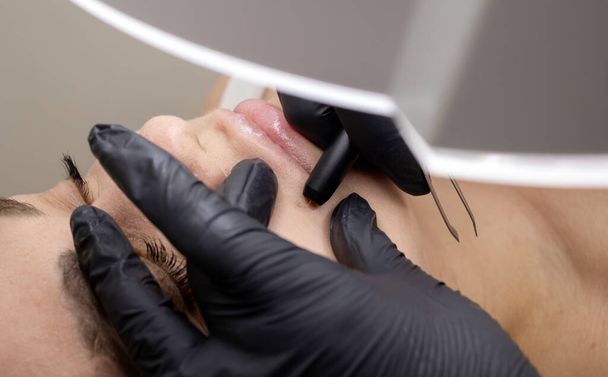 Dermatologist Removes Hair Above Lips On Womans Face With Electrolysis. Electric Epilation In Beauty Salon, Unrecognized Patient. Horizontal Plane. Authentic High Quality Photo - Φωτογραφία, εικόνα