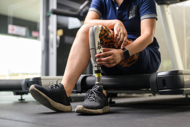Disabled athlete patient with prosthetic leg doing exercise at gym, People with physical disability, High tech technology at prosthetic health care center, New artificial limb for disabled people - Photo, Image