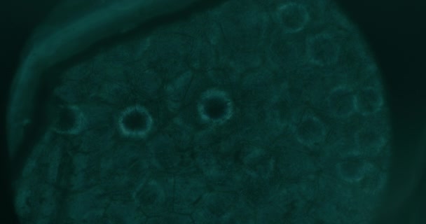 Primer plano de las células cancerosas bajo el microscopio en el laboratorio - Imágenes, Vídeo