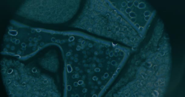 Close-up van kankercellen onder microscoop in het laboratorium - Video