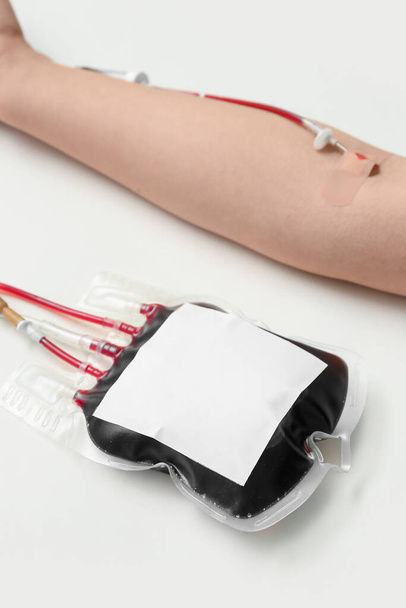 Mujer donando sangre sobre fondo beige, primer plano. Día Mundial del Donante - Foto, imagen