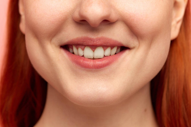 Wybielanie zębów. Portret przycięty z dolną twarzą młodej kobiety o śnieżnobiałym uśmiechu. Zbliż obraz. Model z zadbaną, idealną skórą. Stomatologia, leczenie zębów, uroda, koncepcja zdrowia - Zdjęcie, obraz
