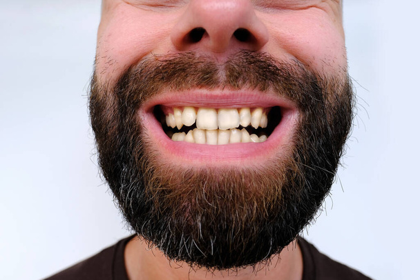 close-up of teeth, oral cavity of patient, charismatic bearded young man 30 years old with open mouth, toothpaste selection, care and hygiene, aesthetic dentistry, care procedures - Photo, Image