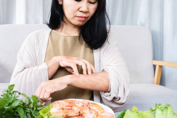 Asiatinnen haben Probleme mit juckenden Hautausschlägen und Kratzern in den Armen, die durch Nahrungsmittelallergien nach dem Essen von Garnelen verursacht werden - Foto, Bild