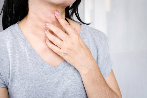 woman hand scratching on her neck, itchy skin - Photo, Image