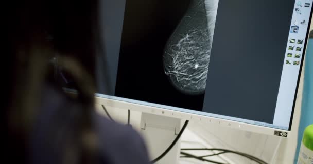 Sken prsu na monitoru počítače. Mamografické zařízení v moderní nemocnici. Ruční záběr mamografu prsu na počítačovém monitoru při nádorovém vyšetření v laboratoři moderní kliniky. - Záběry, video