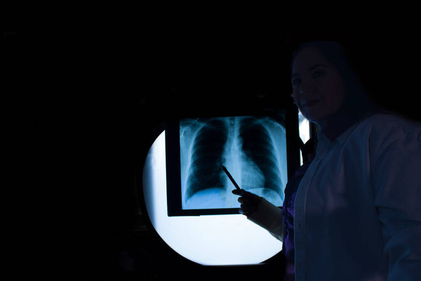 Radiografia toracica anteriore che mostra parenchima polmonare modello radiografico omogeneo e pulsante aortico prominenza revisione da donna polmonologo caucasico - Foto, immagini
