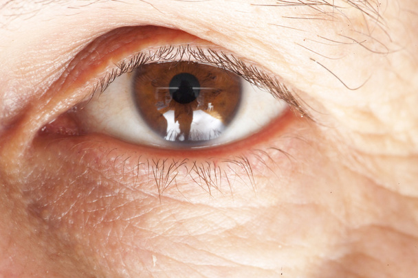 老人性白内障の眼の検査 - 写真・画像