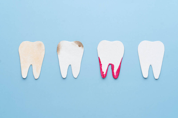 Tandheelkundige problemen cartoon gemaakt van papier. Set tanden met verschillende soorten: tandplak, tandsteen, cariës, bloeding per tandvlees en witte gezonde tanden. Tandheelkundige gezondheidszorg. - Foto, afbeelding