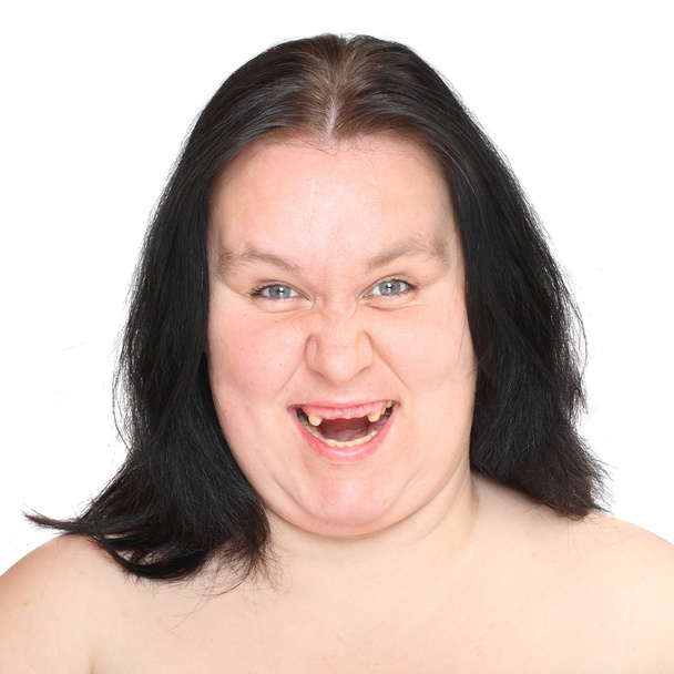 brzydkie kobiety z brakujących zębów. - Zdjęcie, obraz