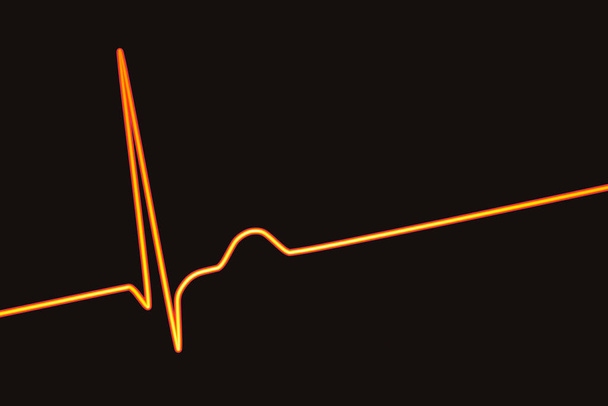 Elektrocardiogram ECG toont een junctioneel ritme, die optreedt wanneer de elektrische signalen in het hart afkomstig zijn van de atrioventriculaire junctie in plaats van de sinoatriale knoop, 3D-illustratie - Foto, afbeelding
