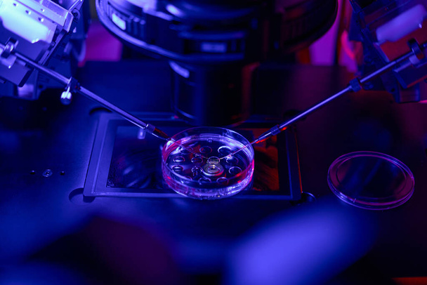Embryoloog verwijdert weinig cellen uit de buitenste laag van embryo, om tests te doen en de overdracht van sommige erfelijke ziekten aan toekomstig kind te voorkomen - Foto, afbeelding