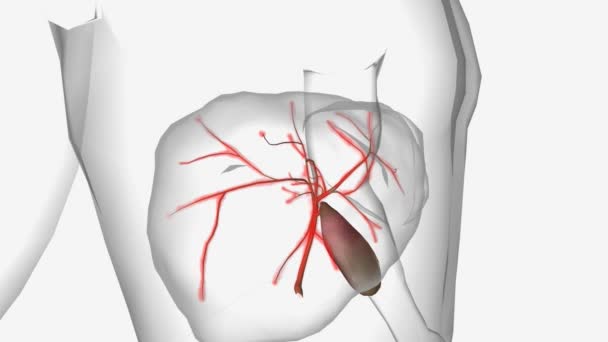 Primární biliární cholangitida Cirhóza 3D animace - Záběry, video
