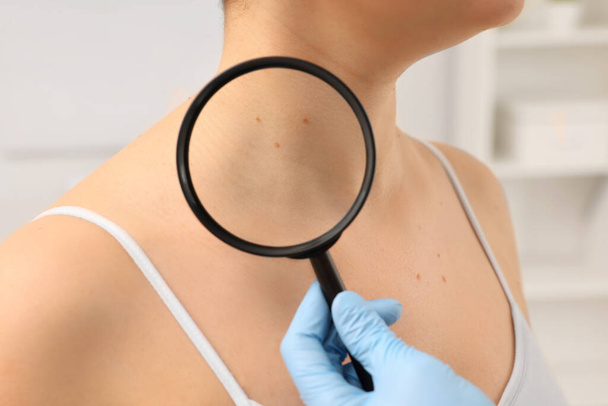 Dermatologist examining patient's birthmark with magnifying glass indoors, closeup - Zdjęcie, obraz