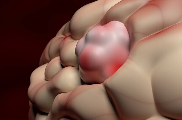 Beyin dokusunda menenjiyom (beyin kanseri) tümörü - 3 boyutlu illüstrasyon yakın görüntüsü - Fotoğraf, Görsel