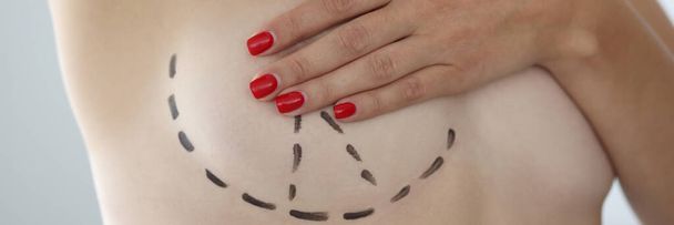 Female breast and black marks for surgery. Breast lift mastopexy and breast augmentation concept - Fotoğraf, Görsel