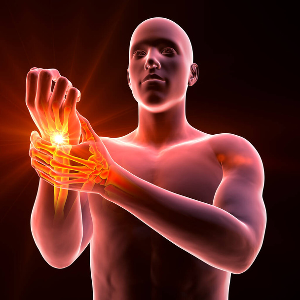 Ένας άνθρωπος που αντιμετωπίζει πόνο στον καρπό, με το σκελετό τονίζεται για να δείξει την πληγείσα περιοχή, 3D εικόνα - Φωτογραφία, εικόνα
