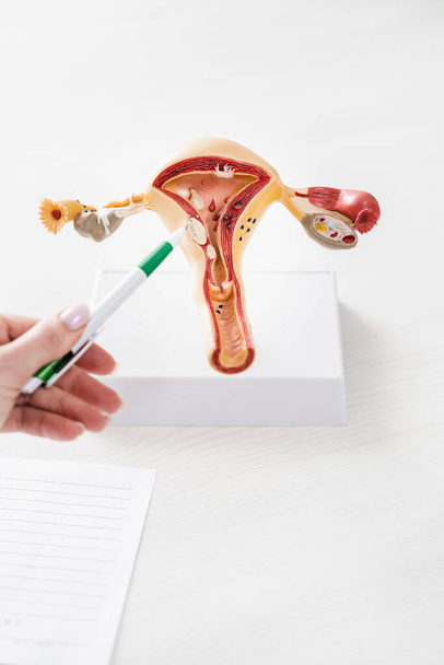 Realistisch baarmoeder model op witte achtergrond close-up. Overleg met een gynaecoloog in een gynaecologiekliniek - Foto, afbeelding