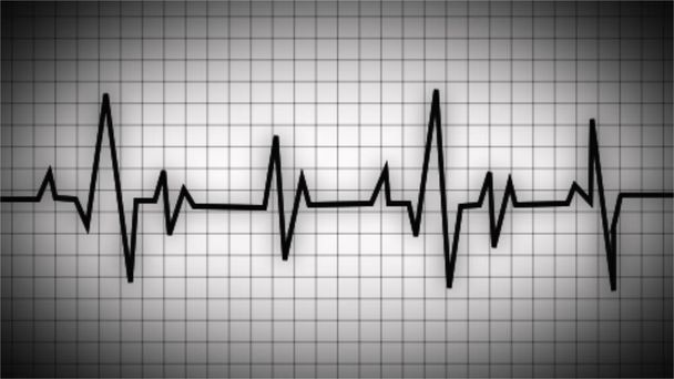 心拍数のグラフ。ハートビートだ。Ekg波アイコン。ハートビートグラフだ。心電図上の通常のハートビートライン(洞のリズム).ECG 。EKG 。生命の兆候だ。健康の象徴として - 写真・画像