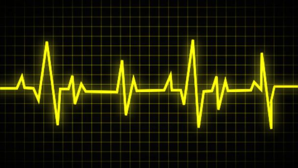 Normal heartbeat line on electrocardiogram (Sinus rhythm). ECG and EKG. indication of life. medical symbol for health - Photo, Image