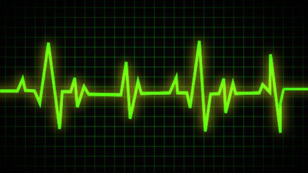Elektrocardiogram, of ECG. Einde van de levensloop. gezondheid medische hartslag puls art design. visueel element met een abstract begrip - Foto, afbeelding