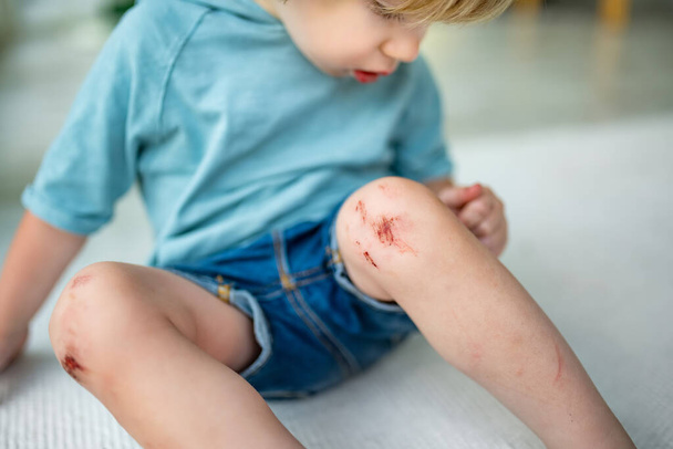 Enfant avec des genoux éraflés douloureux. Parent aider son enfant à effectuer les premiers soins genou blessure après qu'il a été un accident. - Photo, image