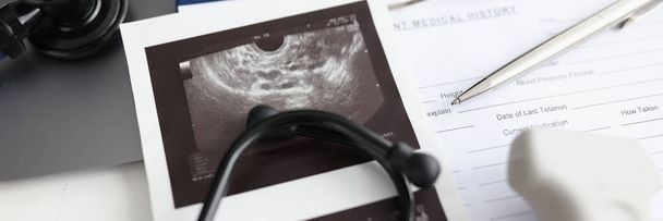Moderne echografie apparaat met sensor en echografie van de baarmoeder. Medische kaart stethoscoop en echografie sonde op tafel - Foto, afbeelding