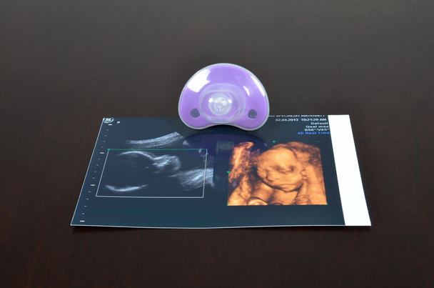 Baby pacifier with ultrasound images - Photo, Image