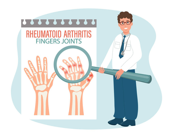 Revmatoidní artritida. Osteoartritida kloubů prstů. Mužský doktor s lupou. Lékařský informační banner, plakát, vektor - Vektor, obrázek