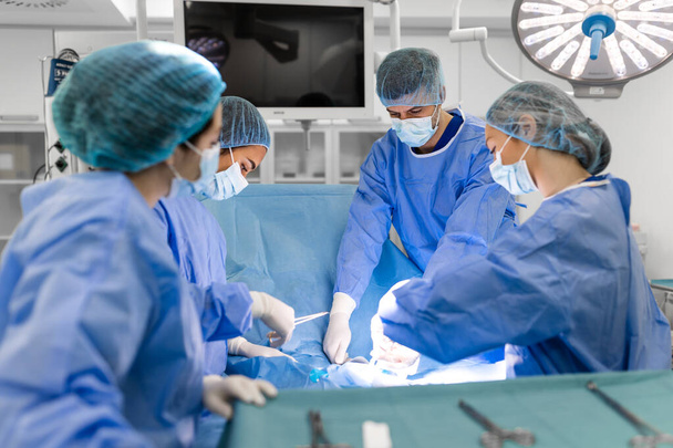 Een team chirurgen vecht voor het leven, voor een echte operatie, voor echte emoties. Het intensive care team vecht voor het leven van de patiënt. Leven redden, de strijd om het leven - Foto, afbeelding