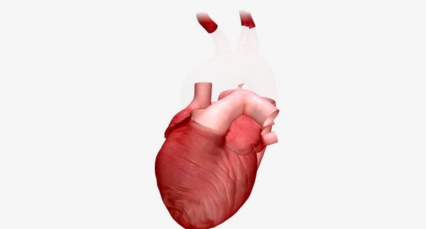 Syntetyczny przeszczep to sztuczna rurka, która pozwala natlenionej krwi płynąć z serca do reszty ciała. Renderowanie 3D - Zdjęcie, obraz