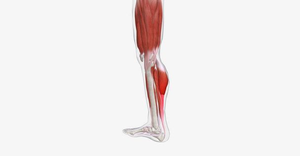 Мышечная судорога - это внезапное, болезненное и непроизвольное сокращение одной или нескольких мышц. 3D рендеринг - Фото, изображение