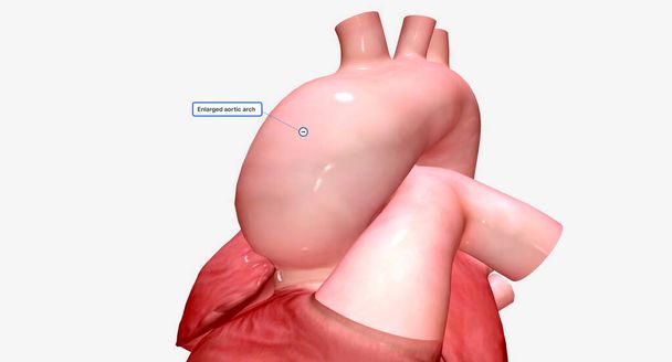 The aortic arch connects the ascending aorta to the descending aorta. 3D rendering - Zdjęcie, obraz