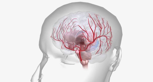 Hemorragische beroerte is een dringende medische aandoening gekenmerkt door een bloeding in of op het oppervlak van de hersen.3D rendering - Foto, afbeelding