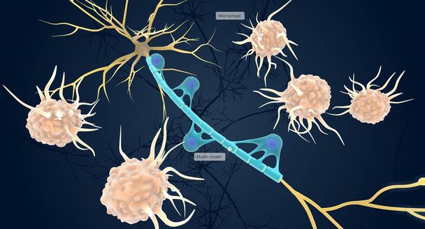 Autoimmune Attack on Myelin Sheath 3D rendering - Foto, afbeelding