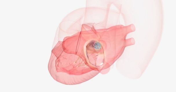Пролапс митрального клапана может привести к тому, что кровь течет назад от левого желудочка в левое предсердие. 3D рендеринг - Фото, изображение