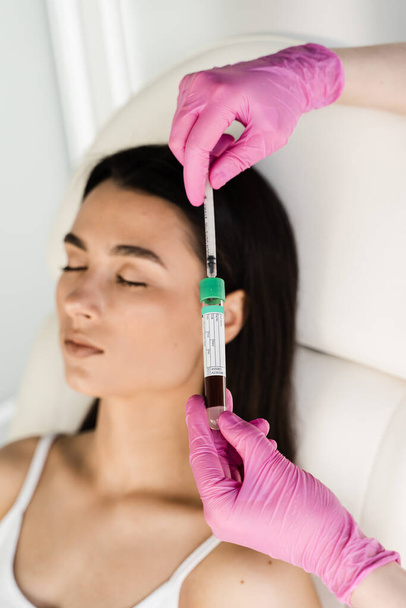 Cosmetologist with test tube with blood and plasma for PRP Platelet Rich Plasma procedure. Platelet Rich Plasma PRP for improves skin volume and texture, reduces flaccidity and fine wrinkles - Foto, imagen