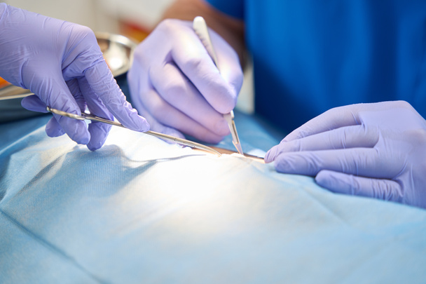 La foto de cerca en la corteza muestra el proceso de la operación quirúrgica. Manos del médico cirujano y su asistente durante la operación - Foto, Imagen