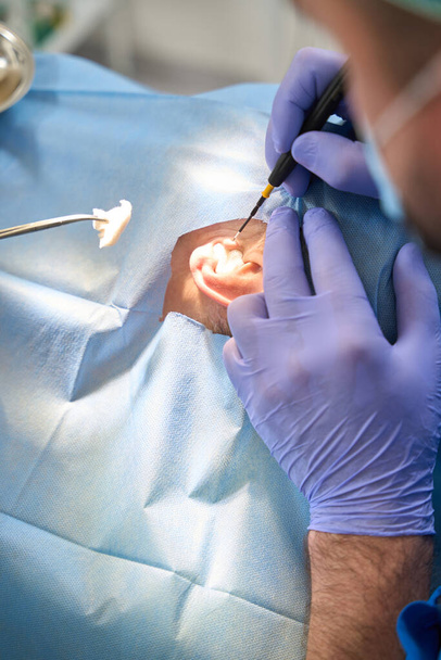 Человек пластический хирург выполняет операцию на ухе пациента с помощью ультразвукового ножа. Пластическая хирургия в области уха - Фото, изображение