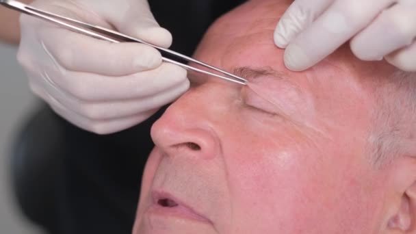 Close-up, onderzoek van het gezicht van een oude man voor plastische chirurgie om het ooggebied te veranderen. Verticale video - Video